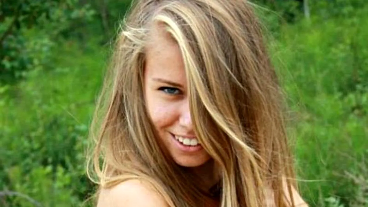 FOTO. Boala extrem de rară de care suferă această adolescentă. 