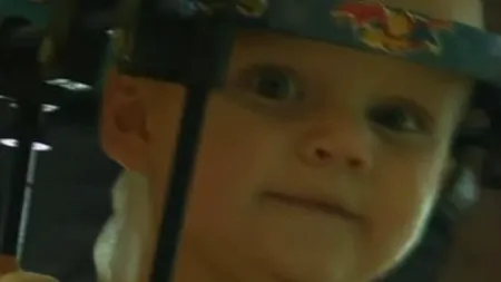Un copil de 16 luni a fost operat cu succes, după ce a suferit o „decapitare internă