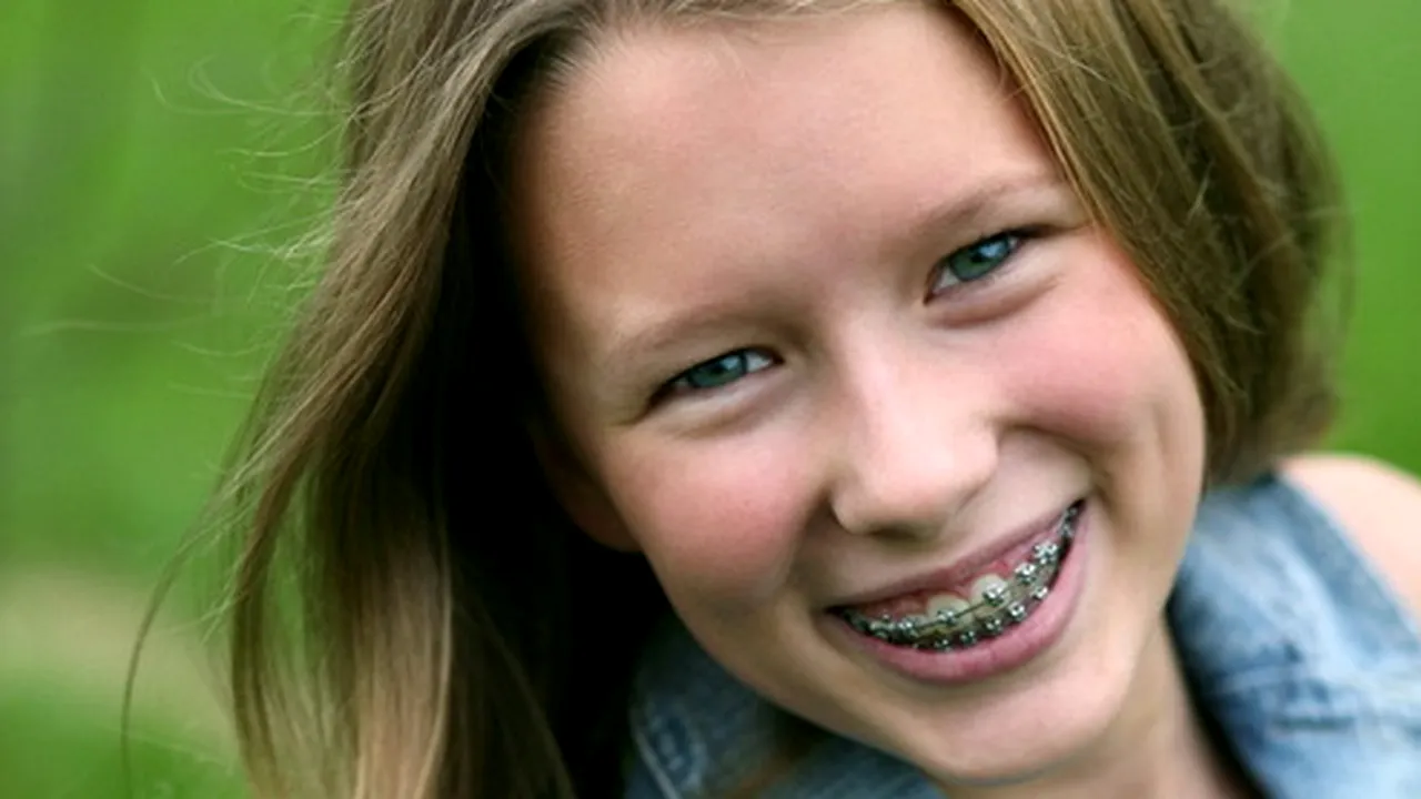 Vești bune: Programul de aplicare a aparatelor dentare pentru elevii bucureșteni a fost prelungit