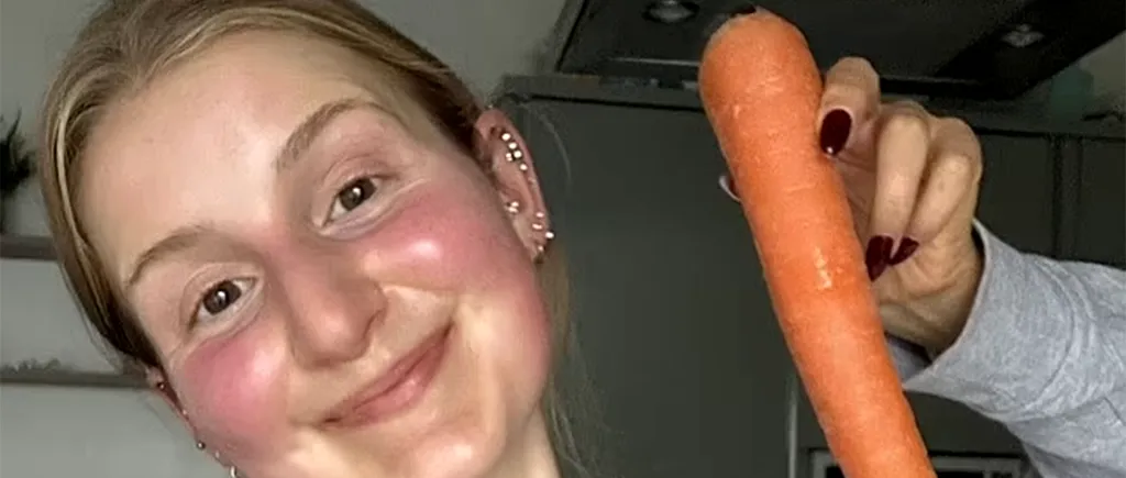 Cum a ajuns să arate această femeie VEGETARIANĂ, după ce a mâncat câte 10 morcovi în fiecare zi. Prietenele ei sunt îngrijorate!