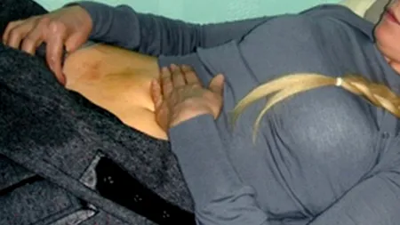 Fotografii cu Iulia Timoșenko bătută, postate pe Facebook. GALERIE FOTO