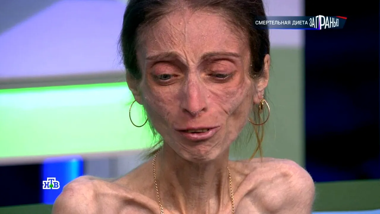 Cât mănâncă, de fapt, Iana, o tânără de 17 de kilograme. I s-a făcut RĂU în direct și a fost dusă la spital!