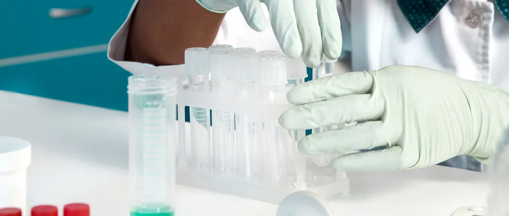 Cauzele rezultatelor false la testarea pentru COVID-19: „RT-PCR este un test foarte sensibil”