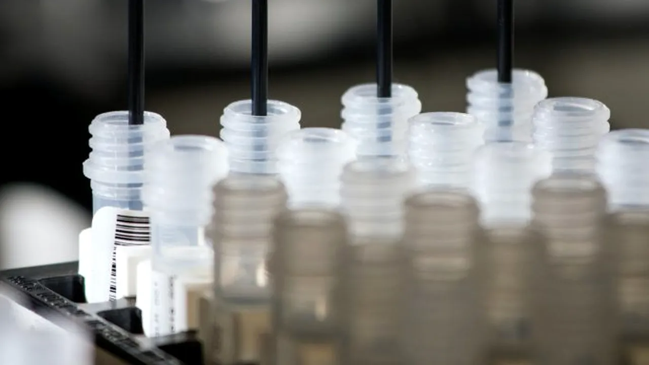 TESTELE ANTICORPILOR  „vor fi cruciale” pentru a determina momentul ridicării blocajelor