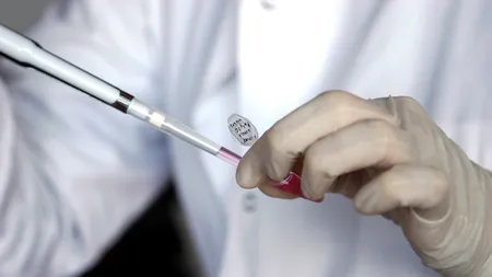 Testul pentru depistarea timpurie a predispoziției la boli grave, adus în România