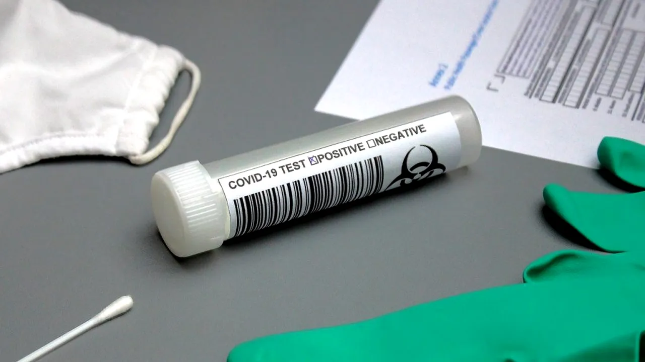 Teste diagnostic și anticorpi COVID-19. Cum afli dacă ești infectat sau dacă ai avut infecția în trecut