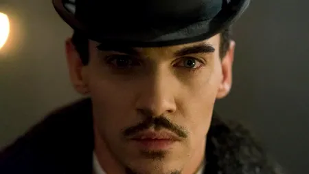 Cum a ajuns să arate un cunoscut actor din cauza dependenței de alcool