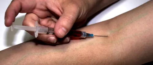 Un medic din Statele Unite a făcut prima alergie severă la vaccinul Moderna. Acesta s-a tratat singur