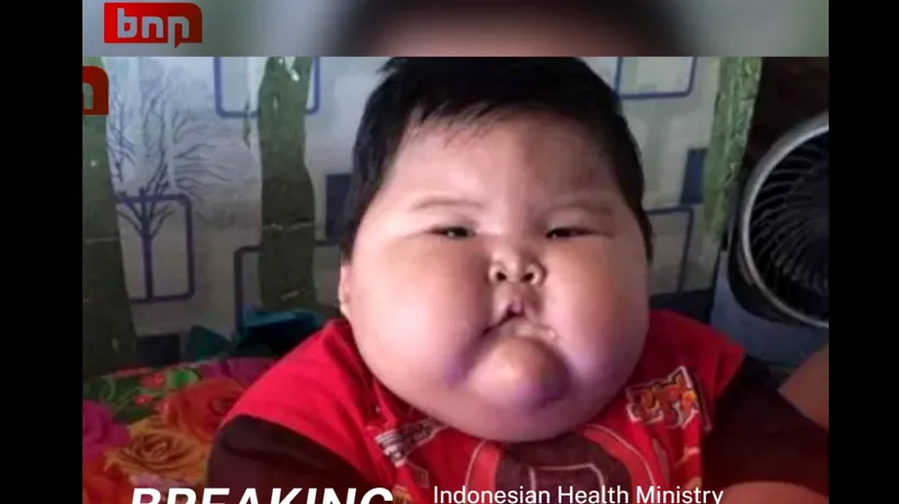Caz bizar în Indonezia! Un bebeluș de 16 luni cântărește cât un copil de opt ani