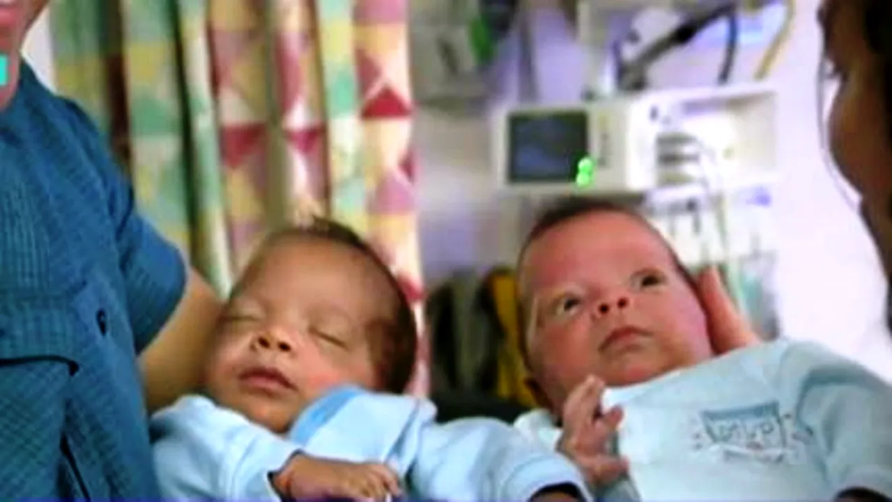 O americancă a născut al doilea geamăn după 24 de zile 