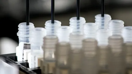 TESTELE ANTICORPILOR  „vor fi cruciale” pentru a determina momentul ridicării blocajelor