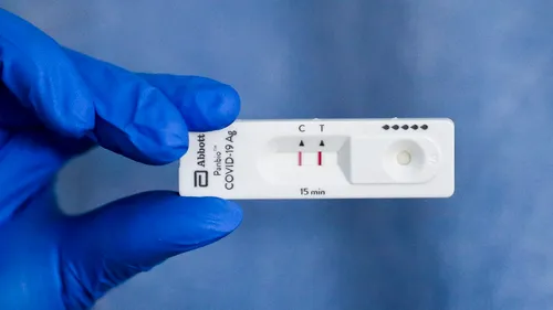 Medicii de familie vor putea face teste antigen pentru depistarea COVID-19. Câți bani vor primi pentru acest nou serviciu