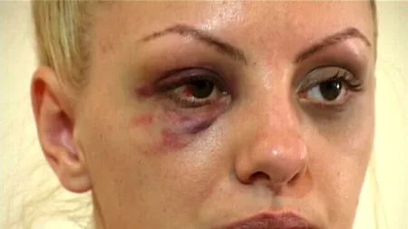 Alexandra Stan nu își revine după ce a fost agresată de impresar. Când va urca din nou pe scenă