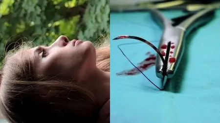 Femei desfigurate după operații estetice făcute „pe genunchi”: „Stai liniștită, am mutilat și pe altele, nu doar pe tine”