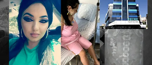 EXCLUSIV | O româncă era să moară după ce a făcut operație de micșorare a stomacului în Turcia. „Mi-au dat morfină și mi-au spus că sunt sănătoasă”
