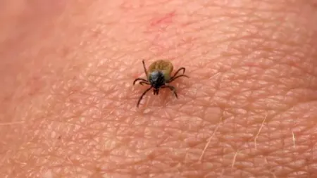 Ce trebuie să faci dacă ești mușcat de o căpușă. Când trebuie să ajungi rapid la SPITAL