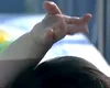 Boala rară care a marcat un sat izolat din Brazilia: ce este sindromul SPOAN și de ce sunt copiii cei mai afectați