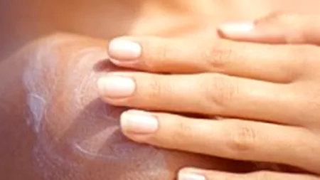 Folosirea cremelor cu SPF pe perioada verii