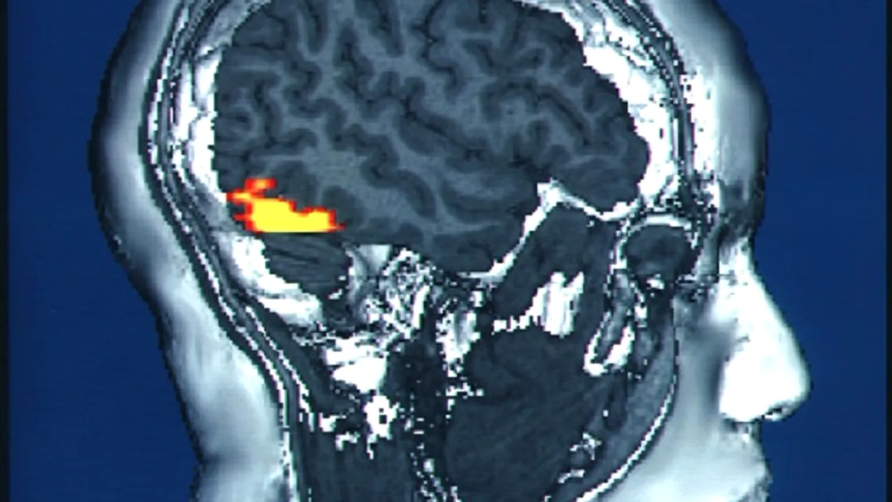 Descoperirea care schimbă tot ceea ce știam despre creierul uman. Ce se întâmplă după adolescență