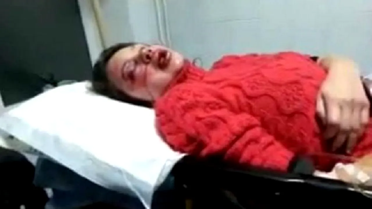 Reacții dure din SUA și UE dupa ce o jurnalistă din Ucraina a fost DESFIGURATĂ! Imaginile sunt șocante
