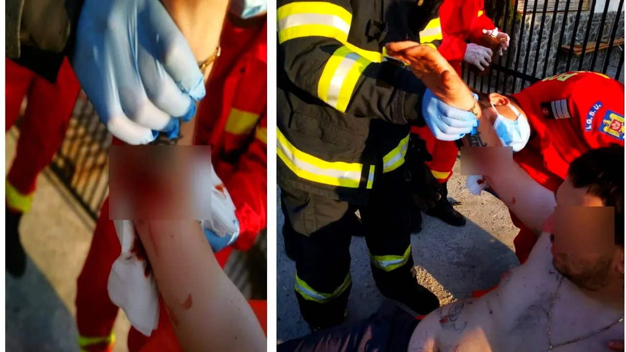 FOTO | Accident teribil chiar înainte de nuntă. Un mire din Râmnicu-Vâlcea a rămas cu mâna înfiptă în țepii unei porți