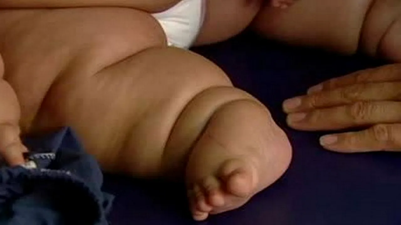 Cântărește de trei ori mai mult decât în mod normal. Cum arată bebelușul care are 21 KG la 8 luni