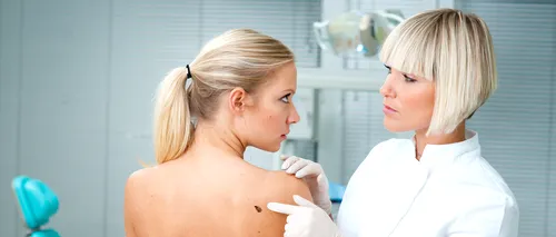 Pericolul pe care-l ascunde refuzul vizitei la dermatolog: Orice aluniță suspectă sau leziune care nu trece ar trebui investigată cu ajutorul biopsiei