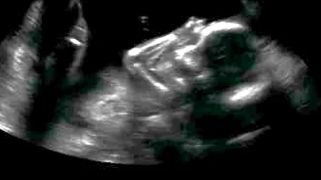 O cercetătoare șochează: HIBRIDUL UMAN născut din împreunarea unei femei cu o specie necunoscută