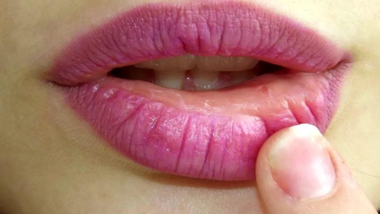 Sângerările inexplicabile la nivelul cavității bucale pot anunța prezența unei boli grave. Semnele care trebuie să te trimită la medic 