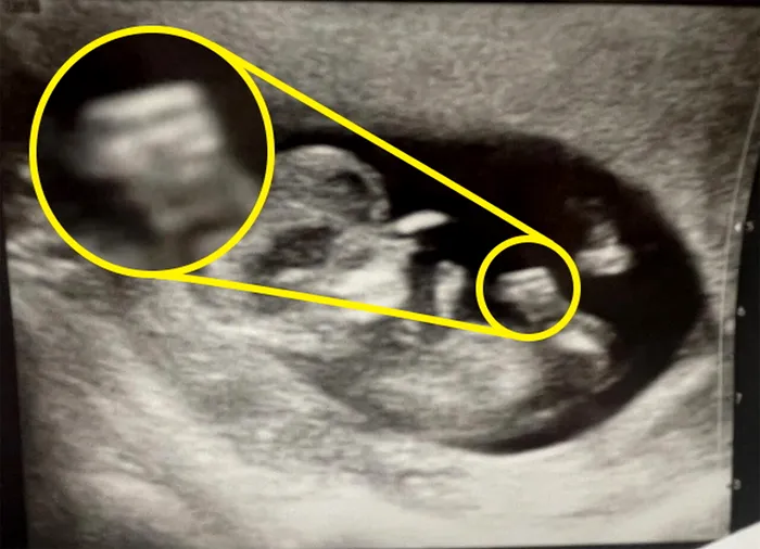 Această femeie gravidă a rămas mască după ce a făcut o ecografie