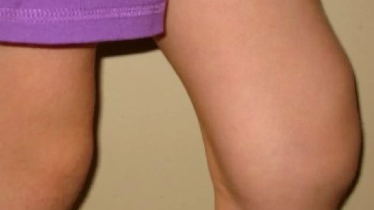 Situație îngrijorătoare. Mii de copii din România suferă de această boală