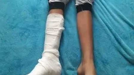 IGNORANȚA face noi victime. Un băiat și-ar fi RUPT piciorul pe terenul plin de GROPI de la școală. Un copil în stare gravă după ce a căzut de la etajul doi al unei școli din Constanța
