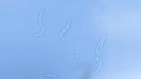 Motivul fascinant pentru care vezi ocazional pete minuscule plutind în ochi