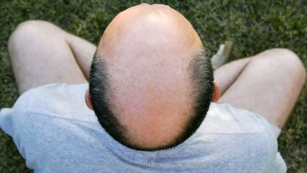 Bărbat chel, decapitat în cadrul unui ritual din Mozambic. Autorii credeau că are aur în cap și au încercat să-l vândă