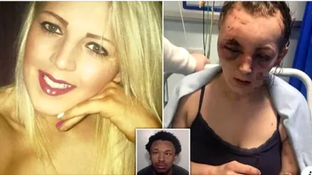 VIOLENȚĂ EXTREMĂ. Tânără de 25 de ani, mutilată de iubitul gelos. Atacul sălbatic a marcat-o pe viață: „M-a tăiat cu un cuțit, m-a lovit cu scaunul și m-a călcat în picioare”
