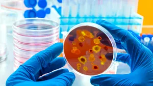 Nouă alertă epidemiologică în Europa: Crește numărul cazurilor de infectare cu „variola maimuțelor”. Portugalia, Spania și Marea Britanie au identificat zeci de cazuri