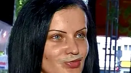 O tânără fotomodel, mutilată după o operație estetică: ''Nu pot să beau, să mănânc, doar plâng''