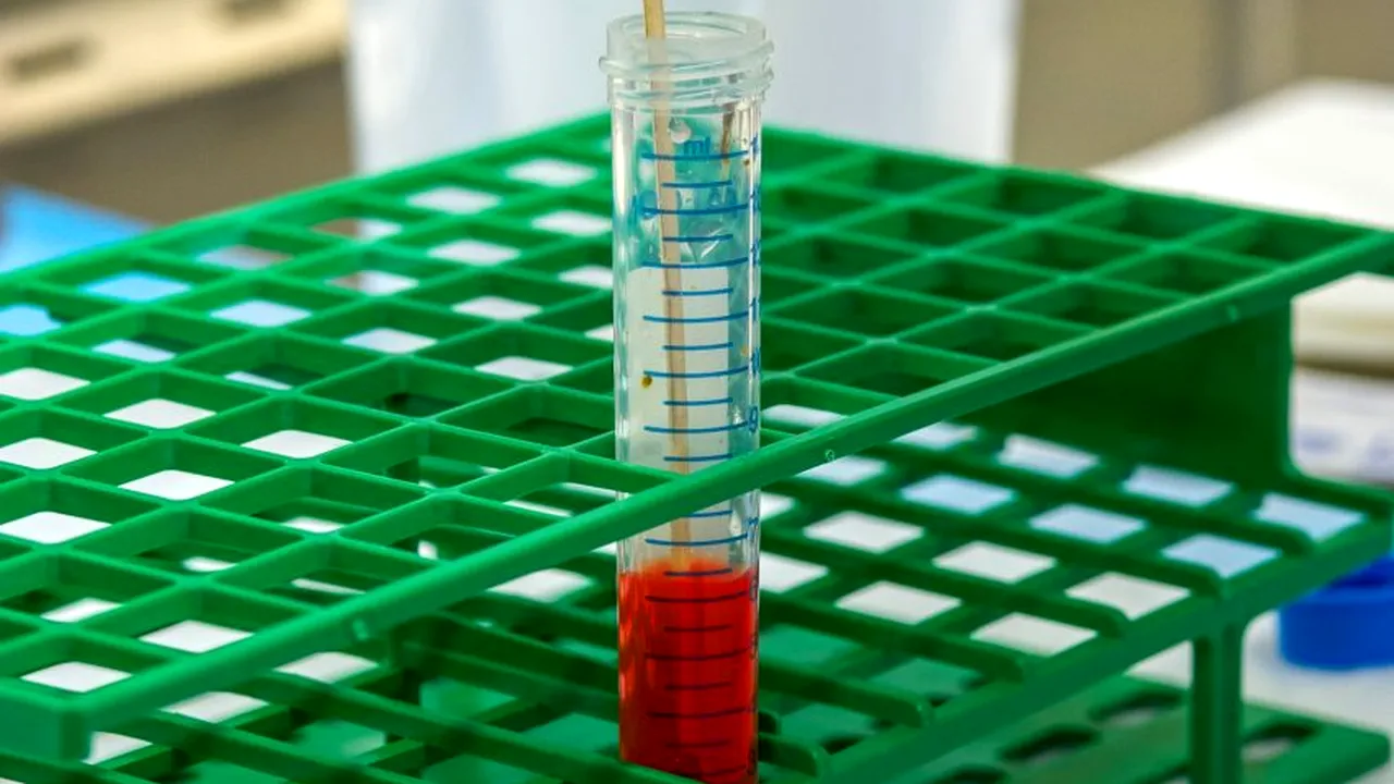 Bilanț Covid în România, 17 iulie 2021: 49 de cazuri şi 2 decese, în ultimele 24 de ore