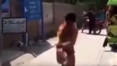 Imagini șocante. Un bărbat a luat foc după ce i-a explodat bateria telefonului