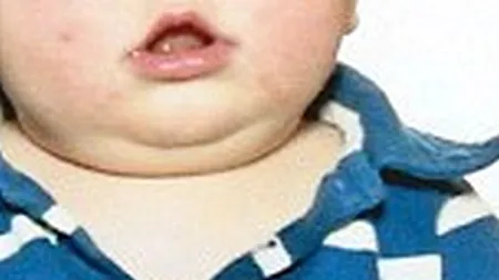 Fotografia care a strâns 525.000 de vizualizări într-o zi