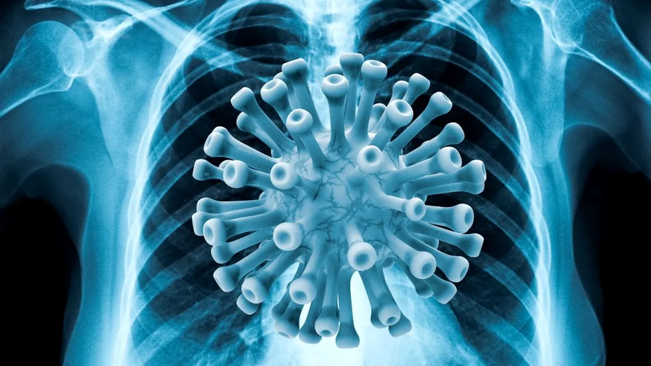 Medic pneumolog, despre modul în care SARS-CoV-2 infestează organismul: Există trei faze ale bolii