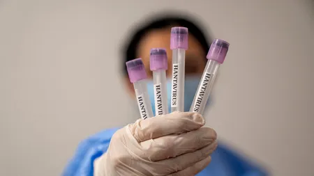 Panica provocată de hantavirus, nejustificată. OMS anunță că noul virus nu va provoca următoarea pandemie