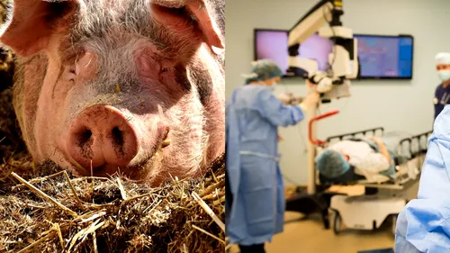 Savanții din Israel au creat organe hibride porc-om pentru transplant