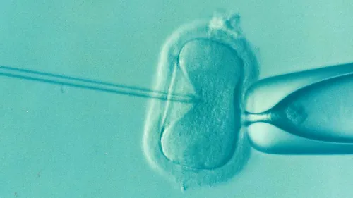 Bancă de spermă, dată în judecată după ce femeia a dat naștere unui copil care suferă de nanism: Am ales special un donator de 1,8 m înălțime. Era ultima mea șansă de a avea un copil 