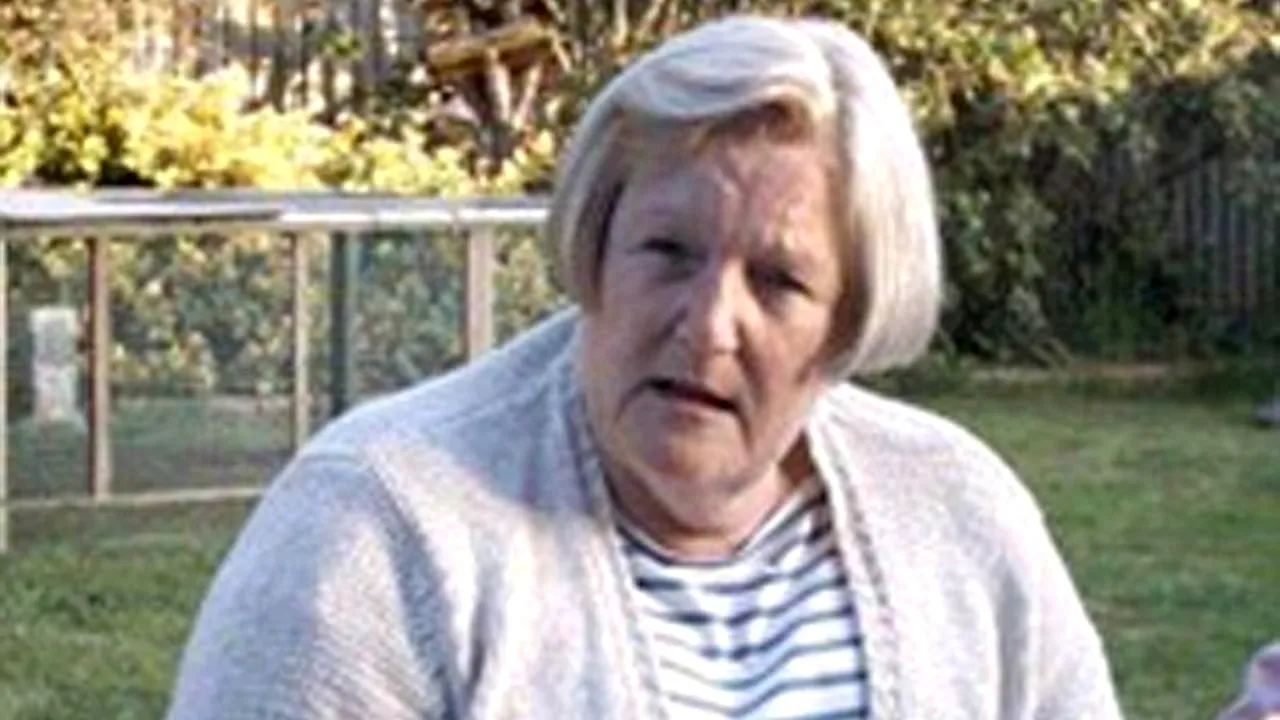 FOTO. Cum arată această femeie după o operație estetică în valoare de 25 de mii de euro