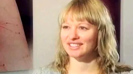 FOTO+VIDEO. Boala ciudată de care suferă această femeie. 