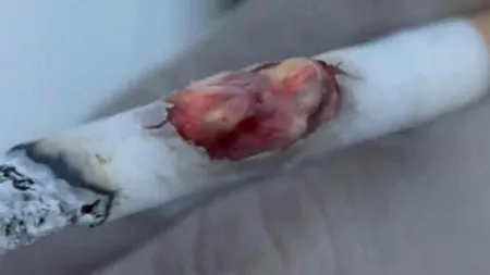 Ce efect are fumatul asupra pielii. GALERIE FOTO 