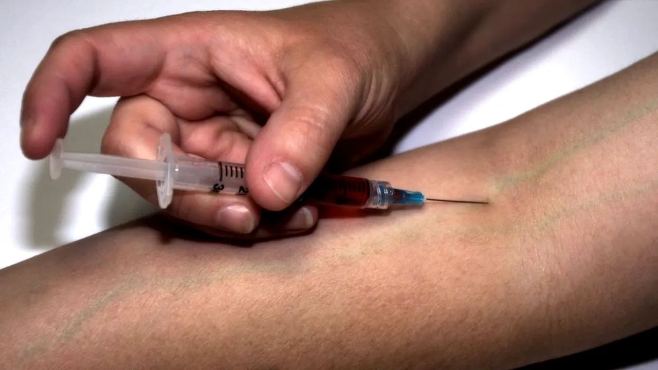 Un medic din Statele Unite a făcut prima alergie severă la vaccinul Moderna. Acesta s-a tratat singur
