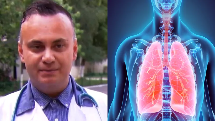 ”Sindromul plămânului alb” a ajuns și în România! Medicul Adrian Marinescu: ”O BACTERIE atipică!”