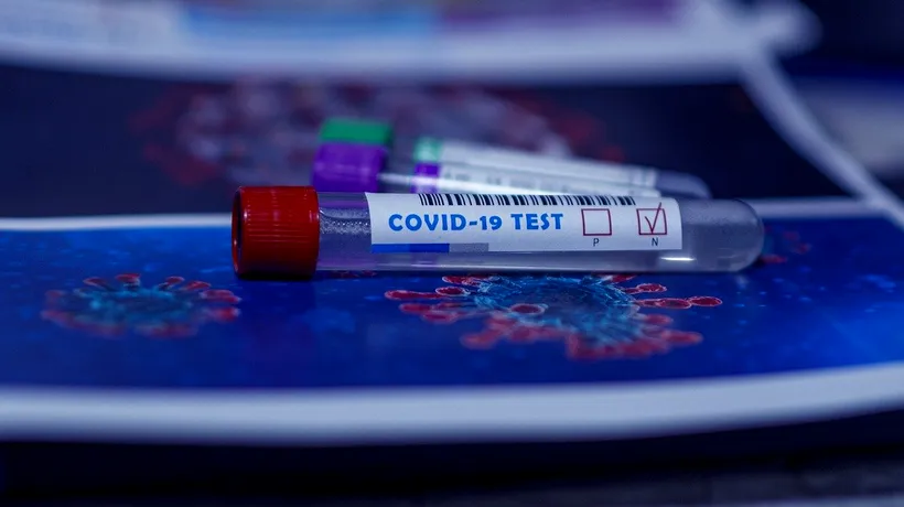 Un studiu „desființează” testele antigen: Jumătate din cele efectuate dau rezultate fals negative! „RT PCR rămân testele gold standard la nivel mondial pentru diagnosticarea COVID-19”
